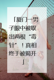 厦门一男子眼中被取出两根“毒针”！真相终于被揭开